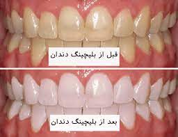 عکس1