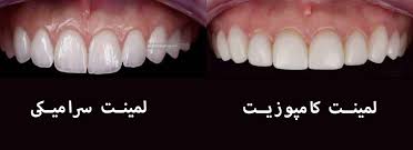 عکس2